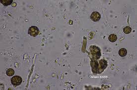Attēlu rezultāti vaicājumam “Chaenotheca ferruginea”
