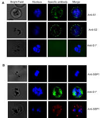 Attēlu rezultāti vaicājumam “Enteridium variabile plasmodium”