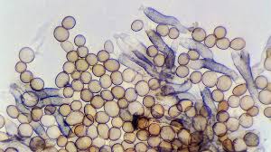 Attēlu rezultāti vaicājumam “Hypoxylon fuscum”