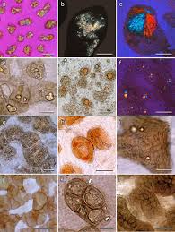 Attēlu rezultāti vaicājumam “Lycogala cf. oleocrystalliferum macro”