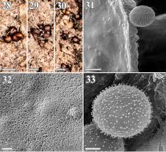 Attēlu rezultāti vaicājumam “Perichaena depressa spores”