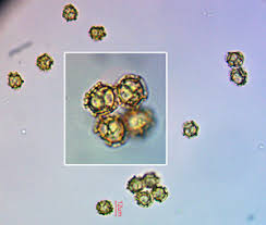 Attēlu rezultāti vaicājumam “Oligonema sp.”