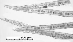 Attēlu rezultāti vaicājumam “Blepharostoma trichophyllum sporophyte”