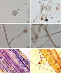 Attēlu rezultāti vaicājumam “Amaurochaete fusiformis spores”