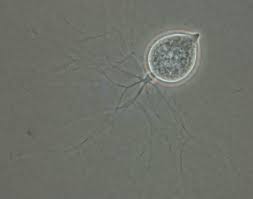 Attēlu rezultāti vaicājumam “Craterium aureum spores”