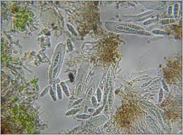 Attēlu rezultāti vaicājumam “Alyxoria varia”