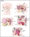 <b>splenectomy</b> (A, 1 and 2).