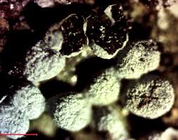 Attēlu rezultāti vaicājumam “Badhamia capsulifera var. arborea spores”