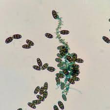 Attēlu rezultāti vaicājumam “Campylopus pyriformis sporophyte”