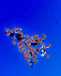 Attēlu rezultāti vaicājumam “Enteridium olivaceum spores”