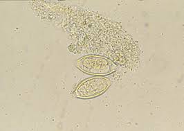 Attēlu rezultāti vaicājumam “Trichia contorta sessile”