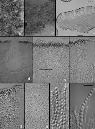 Attēlu rezultāti vaicājumam “Hypocrea rufa”