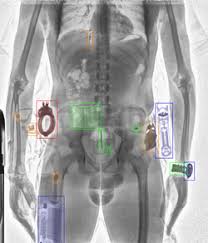 Image result for body scanner