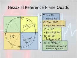 Image result for D.A.R.E!! Development + RadiSense III Y-Axis