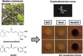 Attēlu rezultāti vaicājumam “Nostoc commune cells”