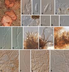 Attēlu rezultāti vaicājumam “Mycosphaerella millegrana”