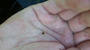 Attēlu rezultāti vaicājumam “Hydrachna”