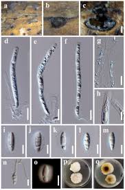 Attēlu rezultāti vaicājumam “Rosellinia desmazieri spores”