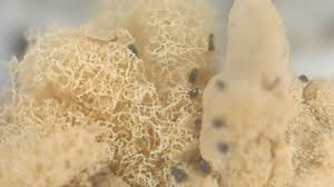 Attēlu rezultāti vaicājumam “Heterotrichia oerstedii (syn. Arcyria oerstedii) spores”