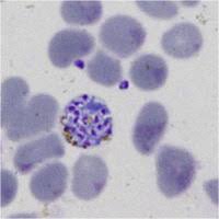 Attēlu rezultāti vaicājumam “Reticularia lobata plasmodium”
