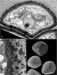Attēlu rezultāti vaicājumam “Fossombronia wondraczekii spores”