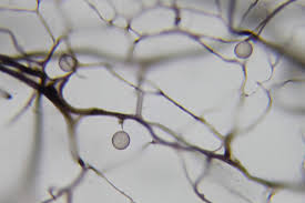 Attēlu rezultāti vaicājumam “Amaurochaete fusiformis”