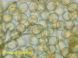 Attēlu rezultāti vaicājumam “Perichaena corticalis spores”