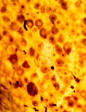 Autonomic perivascular nerve varicosities images and photos ... 