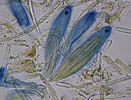 Attēlu rezultāti vaicājumam “Peltigera polydactylon”