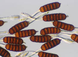 Attēlu rezultāti vaicājumam “Phragmidium sp.”