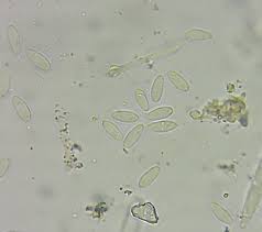 Attēlu rezultāti vaicājumam “Ombrophila violacea”