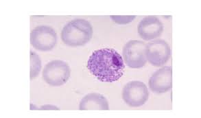 Attēlu rezultāti vaicājumam “Reticularia lobata plasmodium”