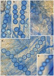 Attēlu rezultāti vaicājumam “Octosporella jungermanniarum”