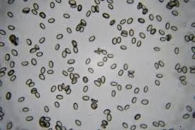 Attēlu rezultāti vaicājumam “Craterium minutum cf. var. brunneum spores”