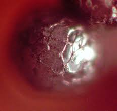 Attēlu rezultāti vaicājumam “Cribraria atrofusca macro”