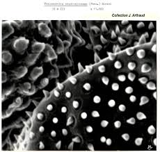 Attēlu rezultāti vaicājumam “Tranzschelia pruni-spinosae spores”