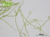 Attēlu rezultāti vaicājumam “Trentepohlia sp.”