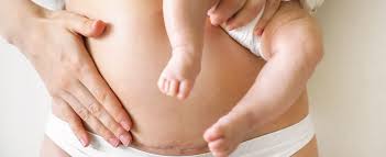 Image result for cesarskie