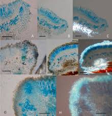 Attēlu rezultāti vaicājumam “Lecanora carpinea”