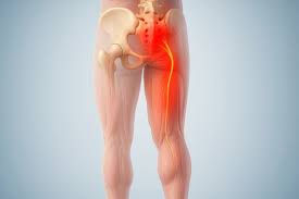 Attēlu rezultāti vaicājumam “Cribraria piriformis”