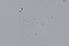 Attēlu rezultāti vaicājumam “Reticularia lobata spores”