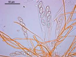 Attēlu rezultāti vaicājumam “Pseudoleskeella nervosa”