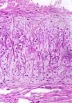 Exercise 7: Cartilage