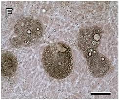 Attēlu rezultāti vaicājumam “Lycogala miserum macro”