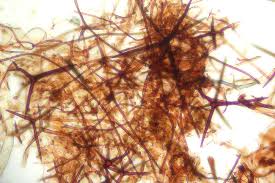 Attēlu rezultāti vaicājumam “Asterodon ferruginosus”