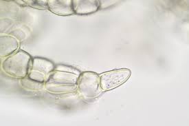 Attēlu rezultāti vaicājumam “Cephalozia connivens macro”