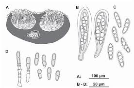 Attēlu rezultāti vaicājumam “Plectocarpon lichenum”