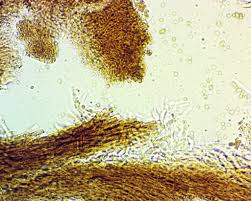 Attēlu rezultāti vaicājumam “Chaenotheca brunneola”