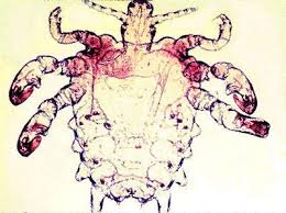 Attēlu rezultāti vaicājumam “Phthiraptera”