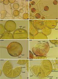 Attēlu rezultāti vaicājumam “Gulielmina vermicularis spores”